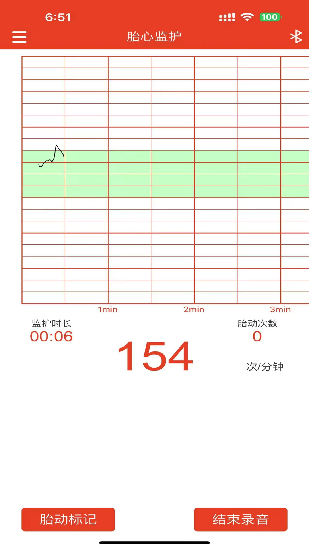 左点胎心仪app下载2024_左点胎心仪安卓软件最新版v1.7