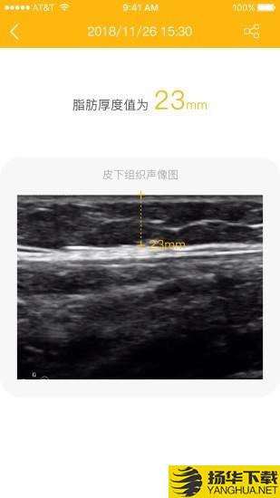 脂肪厚度仪下载最新版（暂无下载）_脂肪厚度仪app免费下载安装