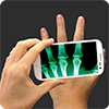 手机扫描骨骼软件下载最新版（暂无下载）_手机扫描骨骼软件app免费下载安装